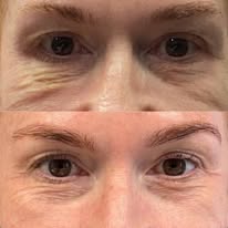 agnesbeforeafter1